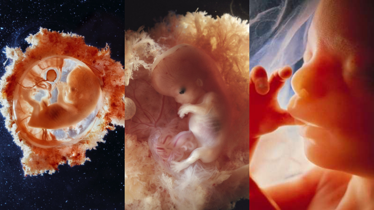 Detail Gambar Bayi Dalam Kandungan 4 Bulan Nomer 18