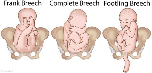 Detail Gambar Bayi Dalam Kandungan 4 Bulan Nomer 52