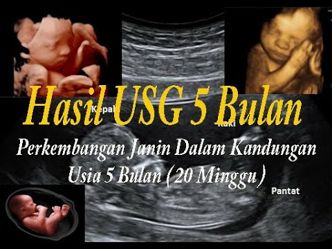 Detail Gambar Bayi Dalam Kandungan 5 Bulan Nomer 12