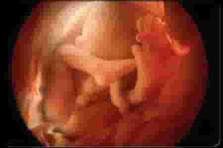 Detail Gambar Bayi Dalam Kandungan 5 Bulan Nomer 24