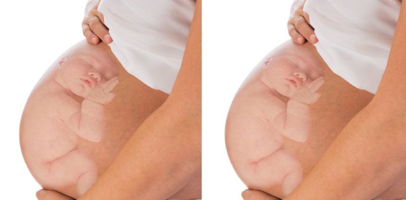 Detail Gambar Bayi Dalam Kandungan 7 Bulan Nomer 3