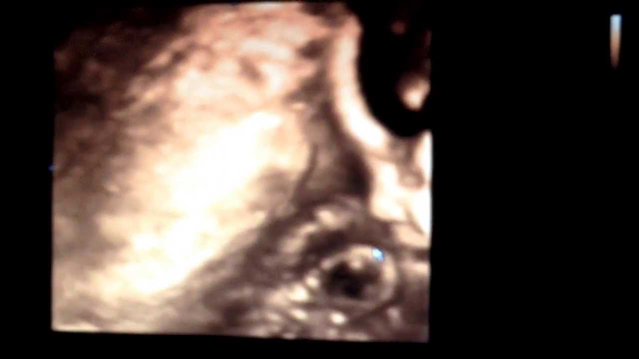 Detail Gambar Bayi Dalam Kandungan 8 Bulan Nomer 46