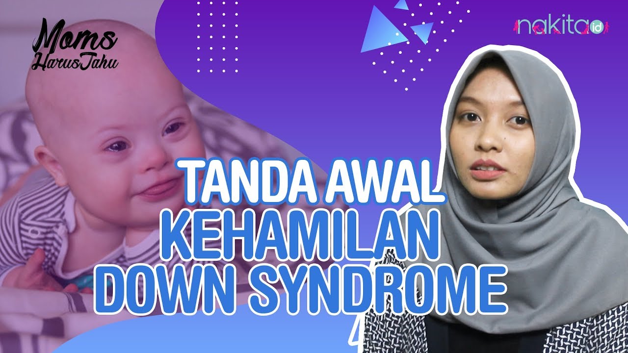 Detail Gambar Bayi Down Syndrome Nomer 12