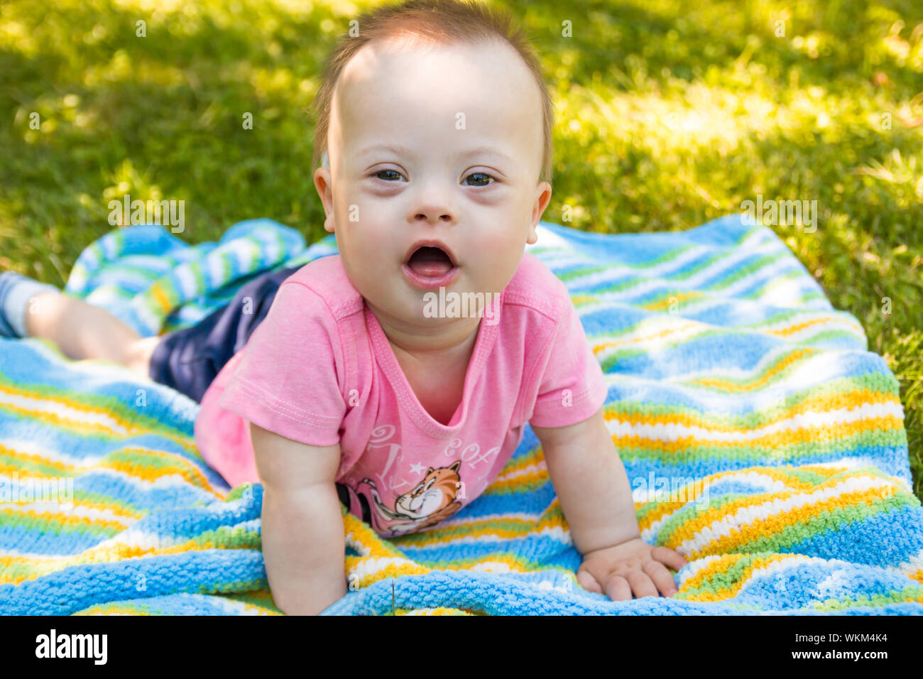 Detail Gambar Bayi Down Syndrome Nomer 25