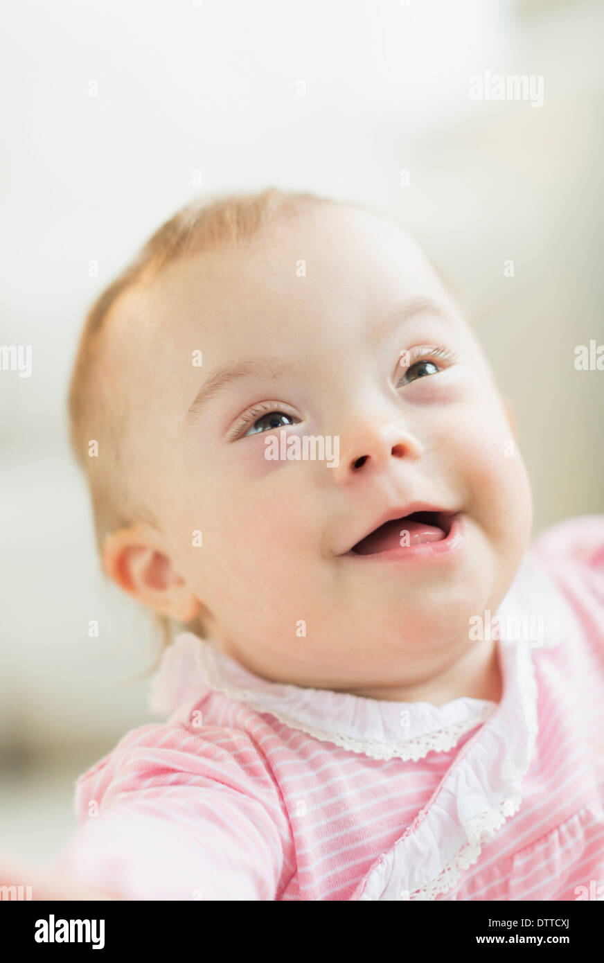 Detail Gambar Bayi Down Syndrome Nomer 43