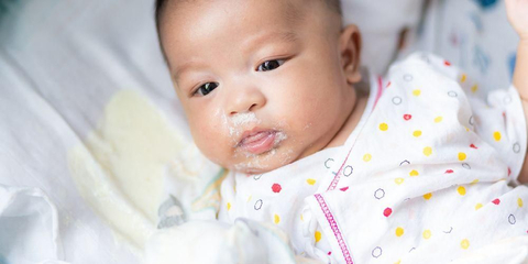 Detail Gambar Bayi Down Syndrome Nomer 45