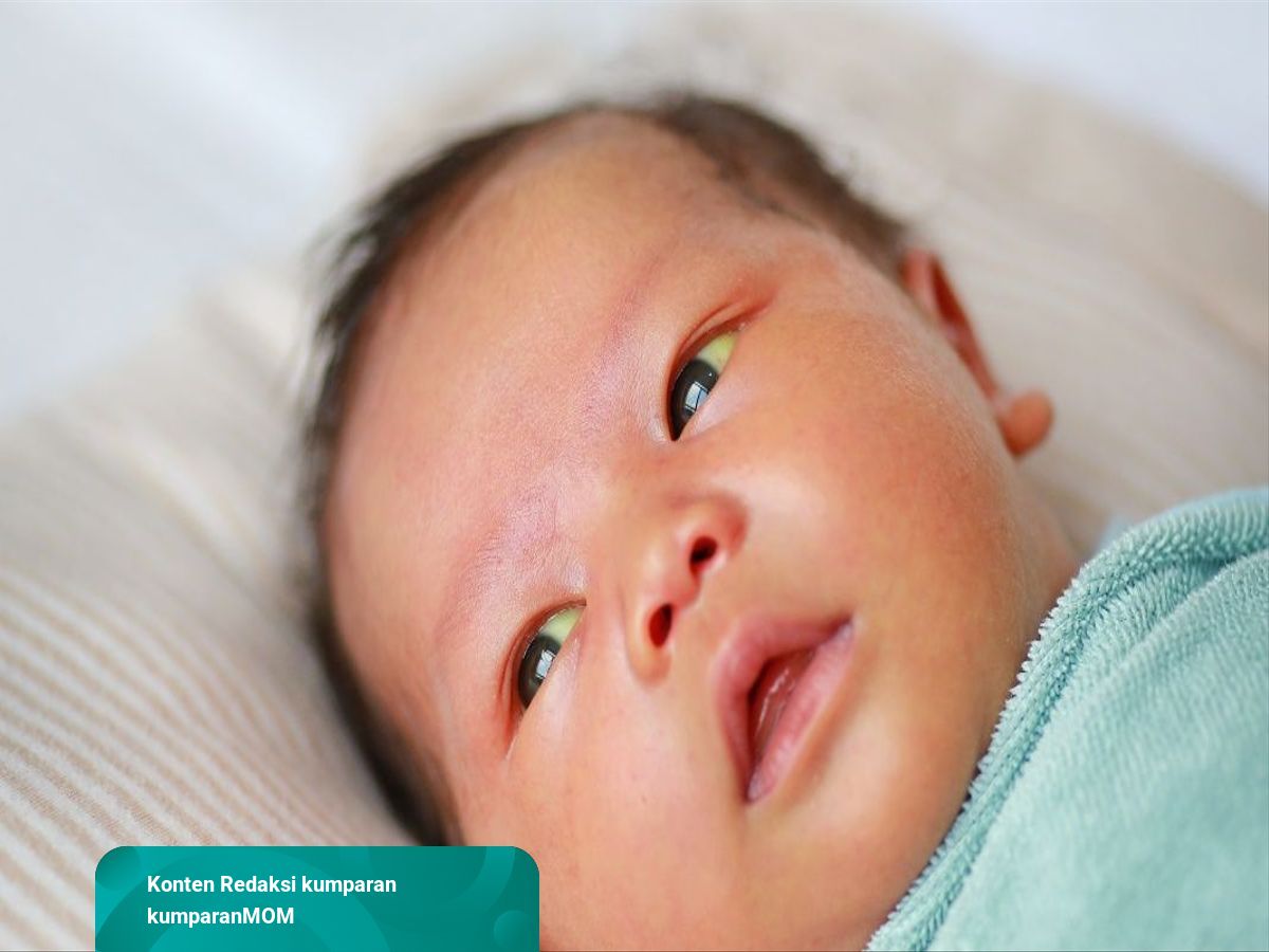 Detail Gambar Bayi Kuning Nomer 25