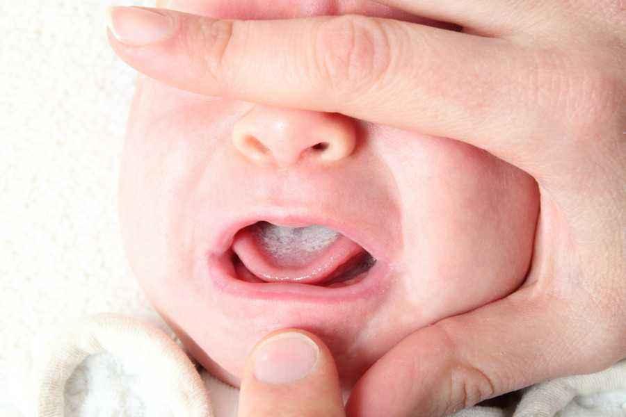 Detail Gambar Bayi Mengatupkan Mulut Nomer 2