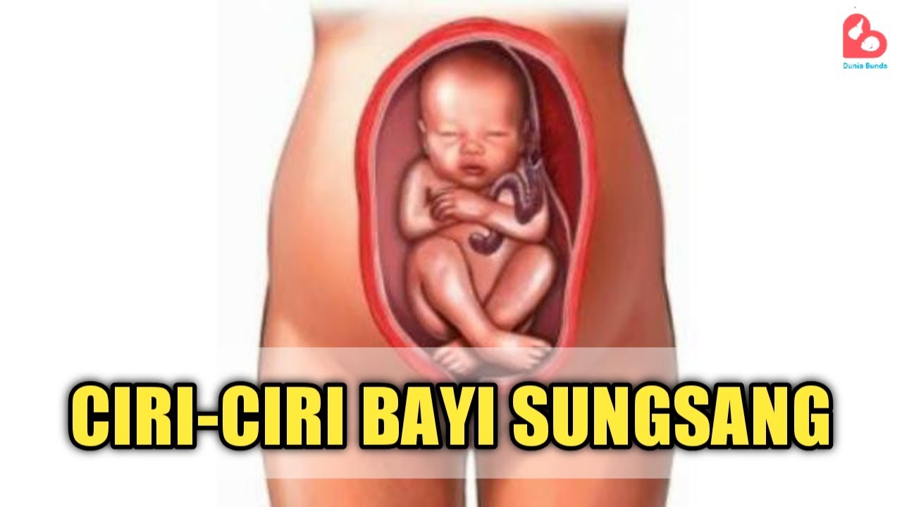 Detail Gambar Bayi Sungsang Nomer 28