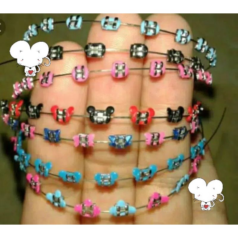 Detail Gambar Behel Lepas Pasang Nomer 12