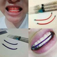 Detail Gambar Behel Lepas Pasang Nomer 18