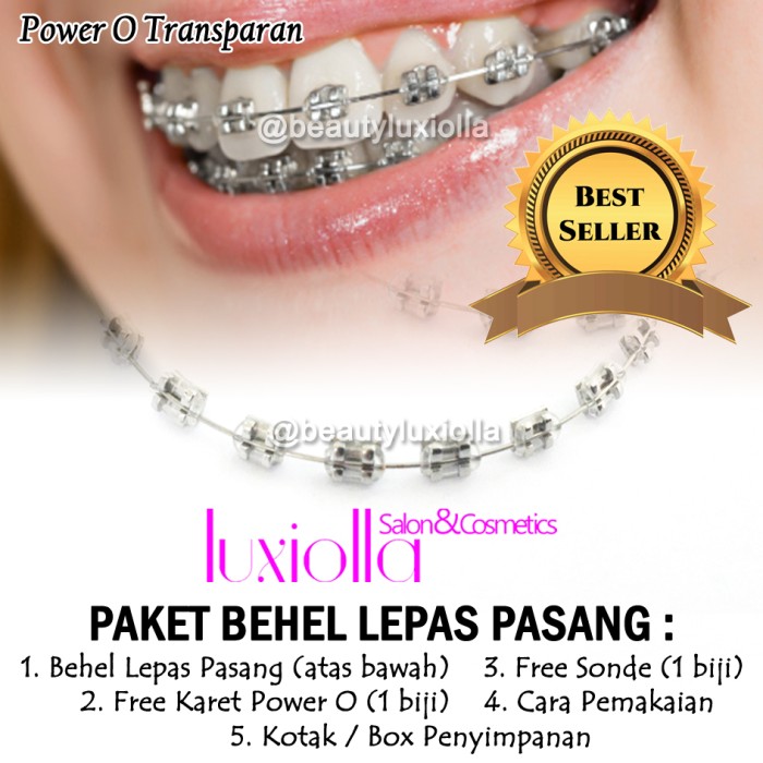 Detail Gambar Behel Lepas Pasang Nomer 26