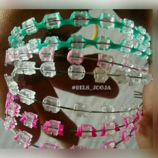 Detail Gambar Behel Lepas Pasang Nomer 29