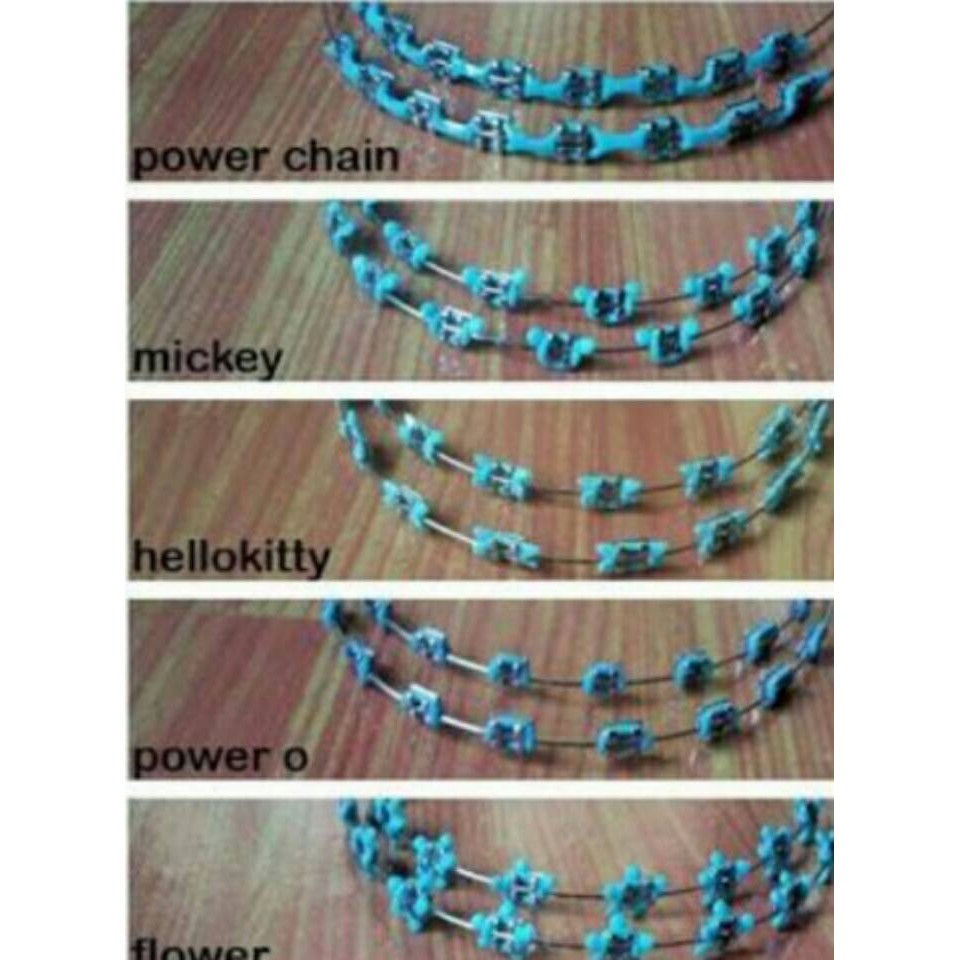 Detail Gambar Behel Lepas Pasang Nomer 35