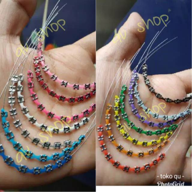 Detail Gambar Behel Lepas Pasang Nomer 5