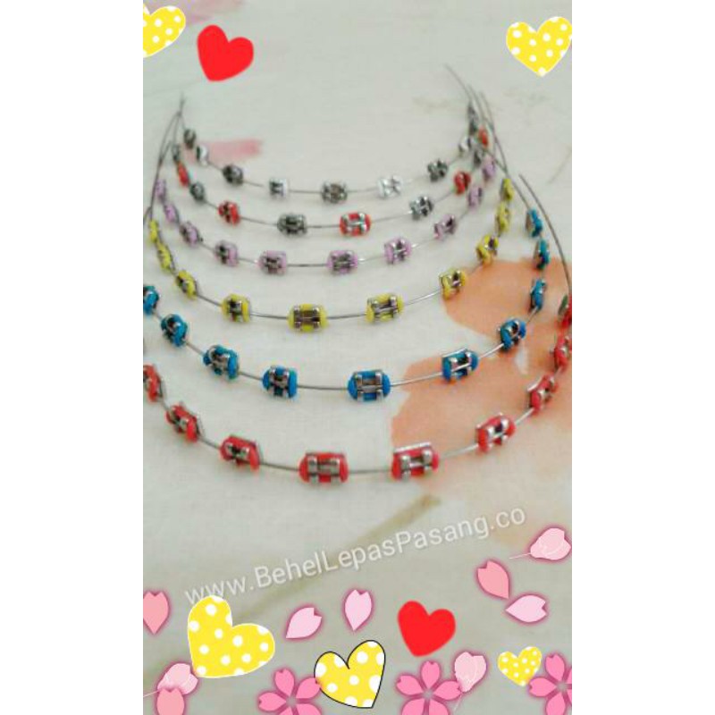 Detail Gambar Behel Lepas Pasang Nomer 41