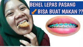 Detail Gambar Behel Lepas Pasang Nomer 44
