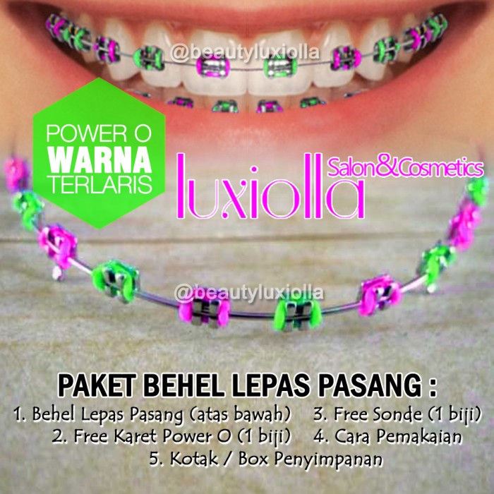 Detail Gambar Behel Lepas Pasang Nomer 56