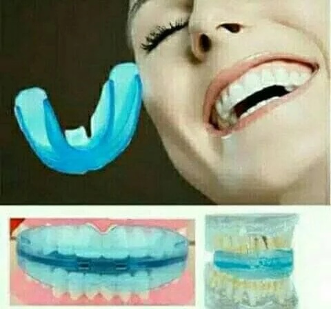 Detail Gambar Behel Lepas Pasang Nomer 58