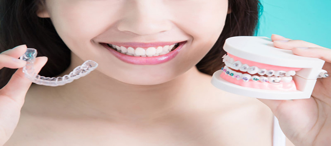 Detail Gambar Behel Lepas Pasang Nomer 10