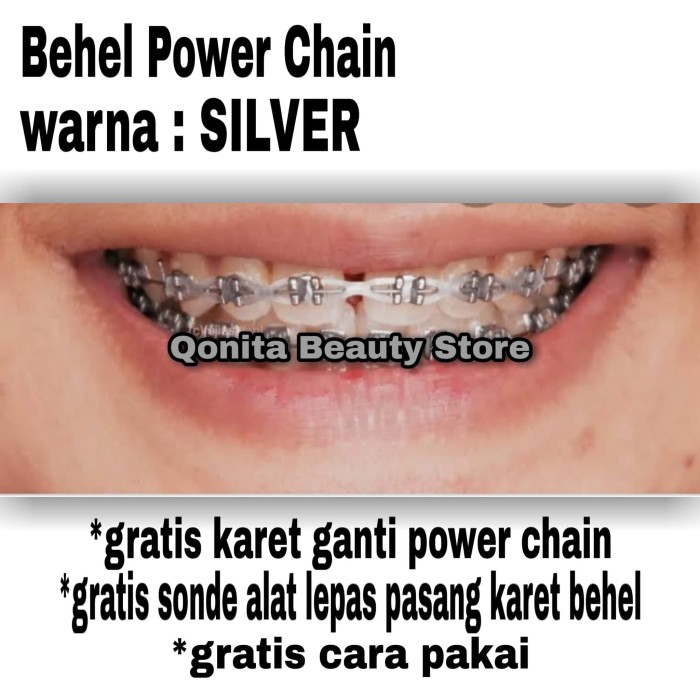 Detail Gambar Behel Power Chain Nomer 18