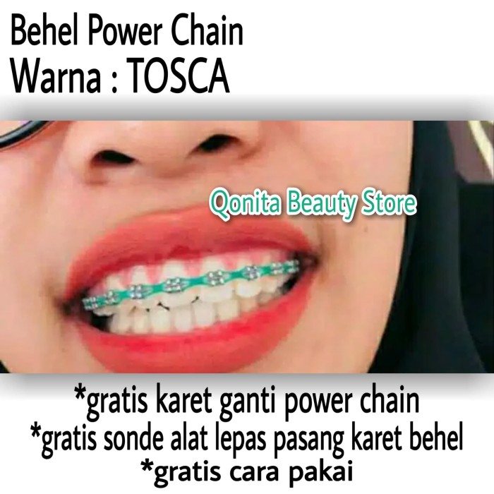 Detail Gambar Behel Power Chain Nomer 19