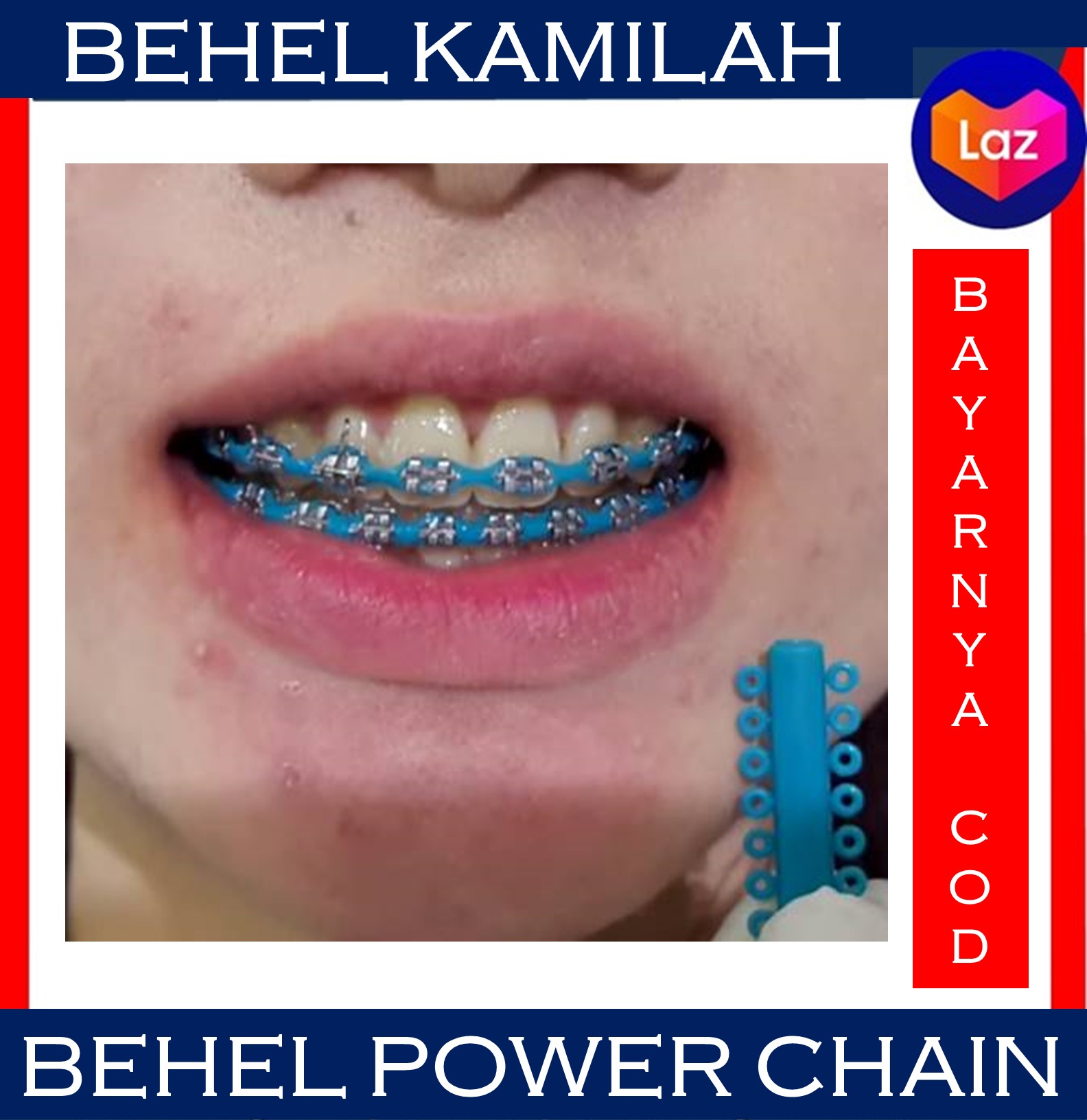 Detail Gambar Behel Power Chain Nomer 39