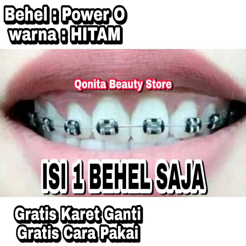 Detail Gambar Behel Warna Warni Nomer 29