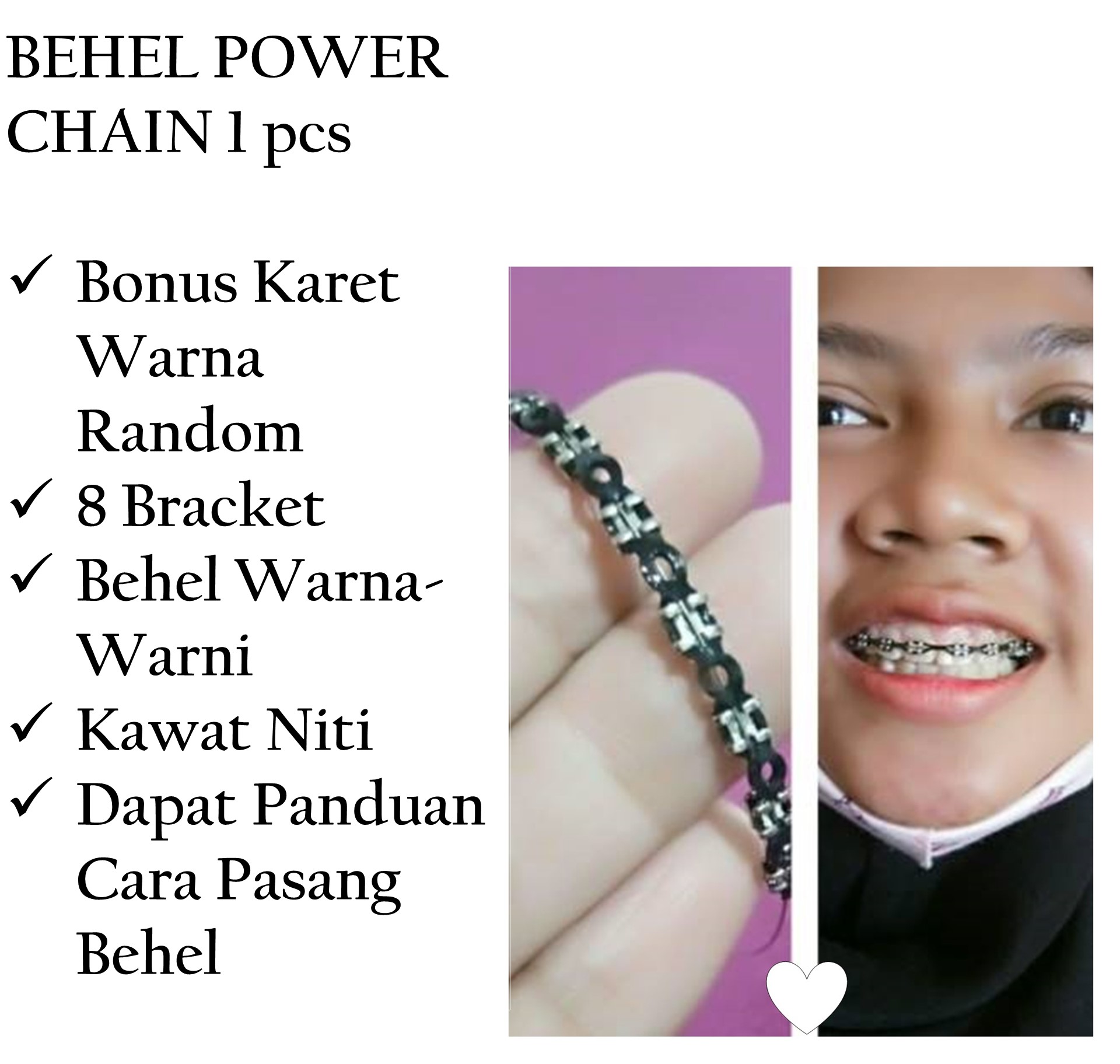 Detail Gambar Behel Warna Warni Nomer 54