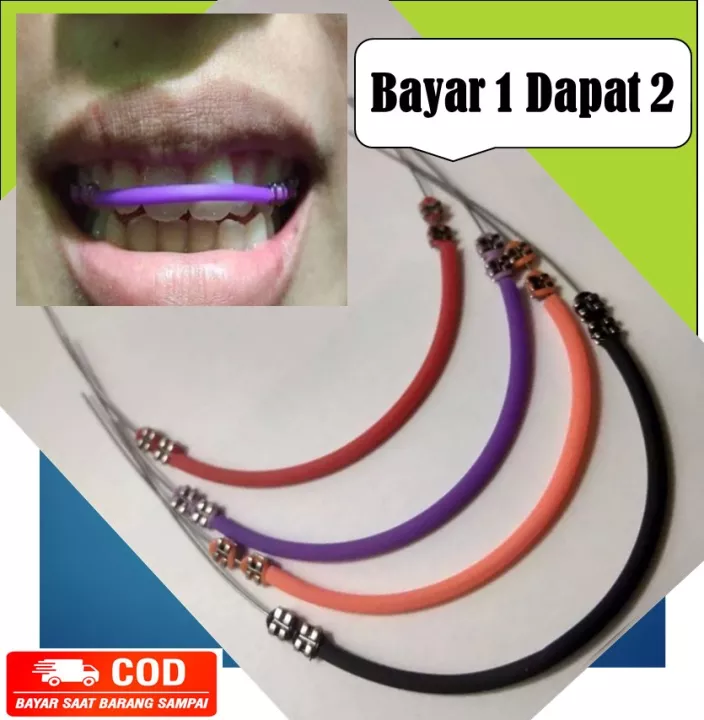 Detail Gambar Behel Warna Warni Nomer 56