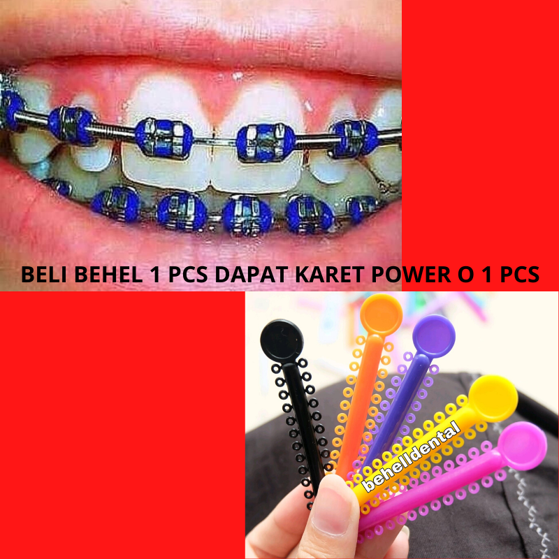 Detail Gambar Behel Warna Warni Nomer 8