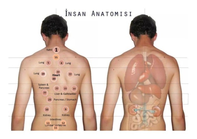 Detail Gambar Bekam Badan Nomer 29