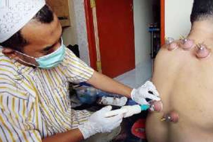 Detail Gambar Bekam Badan Nomer 45