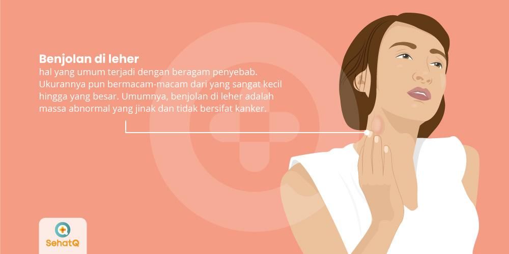 Detail Gambar Benjolan Di Leher Nomer 30