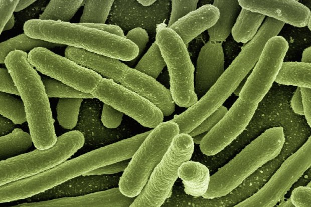 Detail Gambar Bentuk Bentuk Bakteri Dan Penyebab Penyakitnya Nomer 34