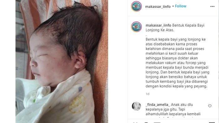 Detail Gambar Bentuk Kepala Peyang Nomer 16