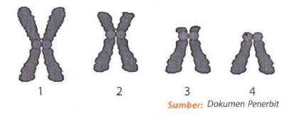 Detail Gambar Bentuk Kromosom Nomer 10