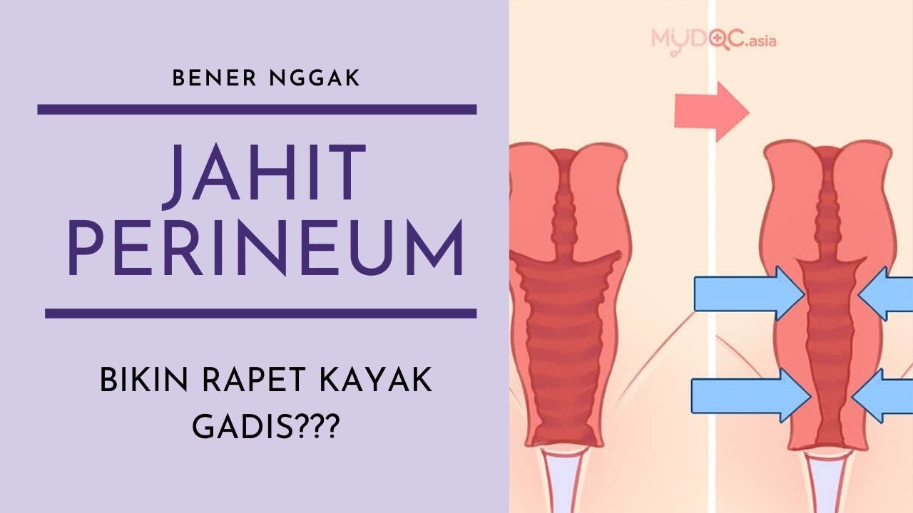 Detail Gambar Bentuk Miss V Setelah Melahirkan Nomer 17