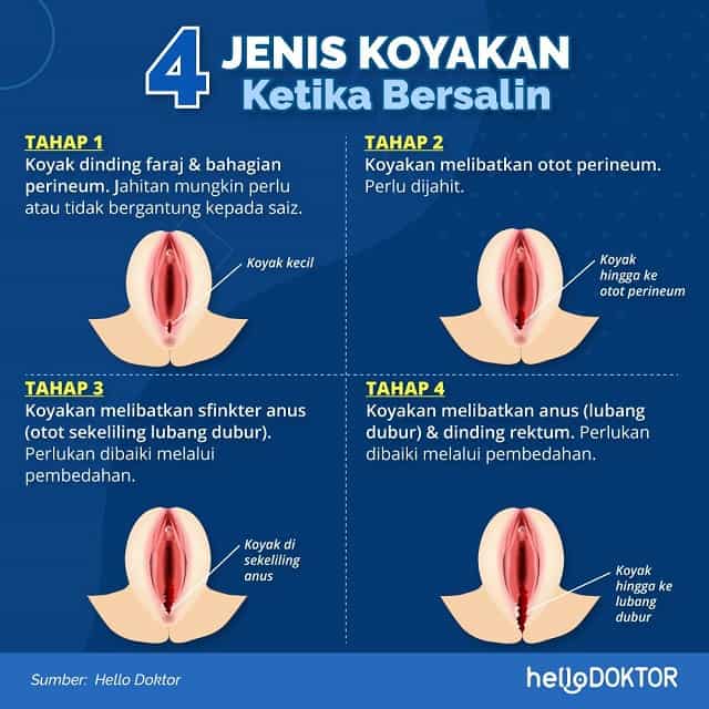 Detail Gambar Bentuk Miss V Setelah Melahirkan Nomer 44