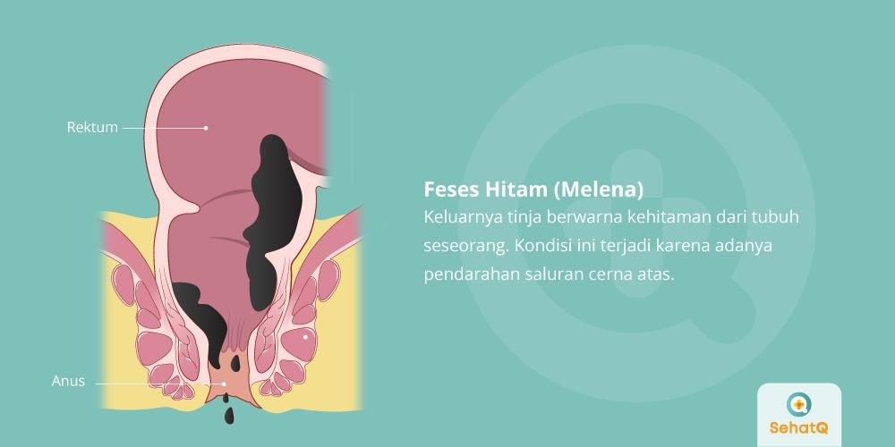 Detail Gambar Berwarna Hitam Nomer 38