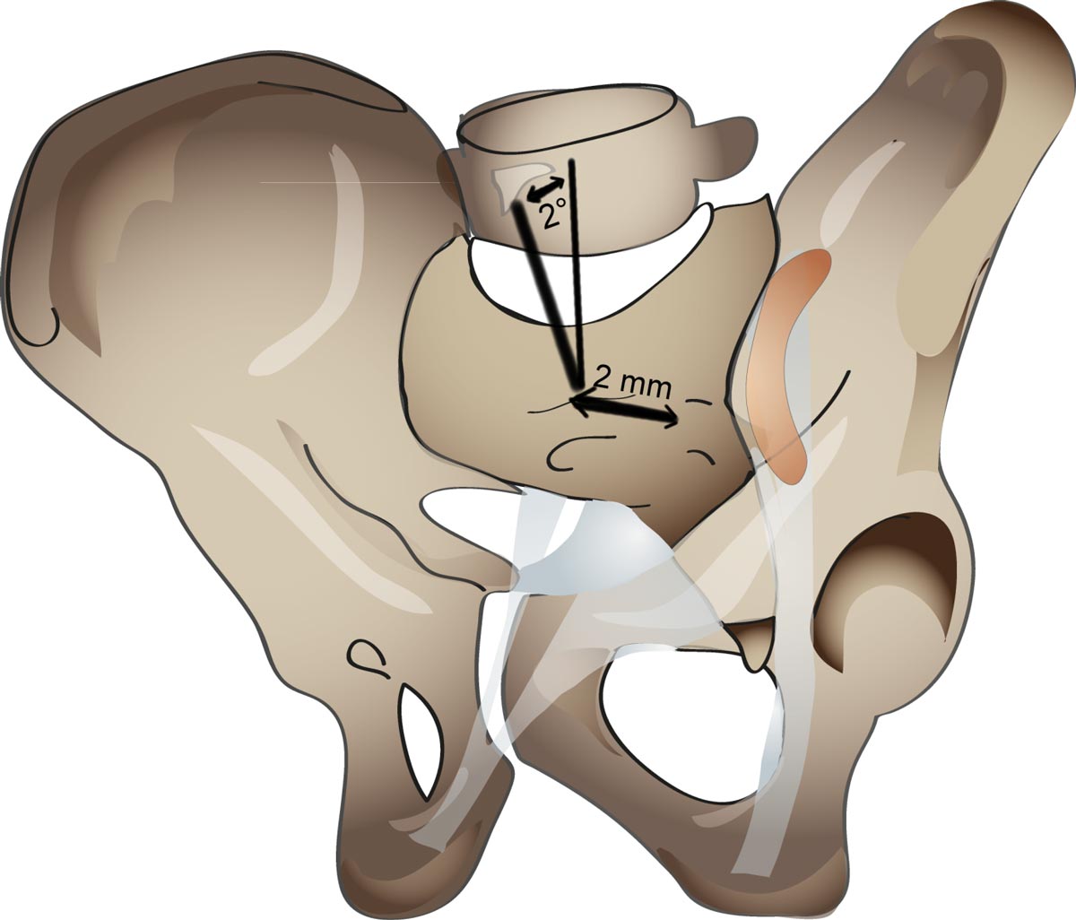 Detail Acetabulum Anatomie Nomer 10