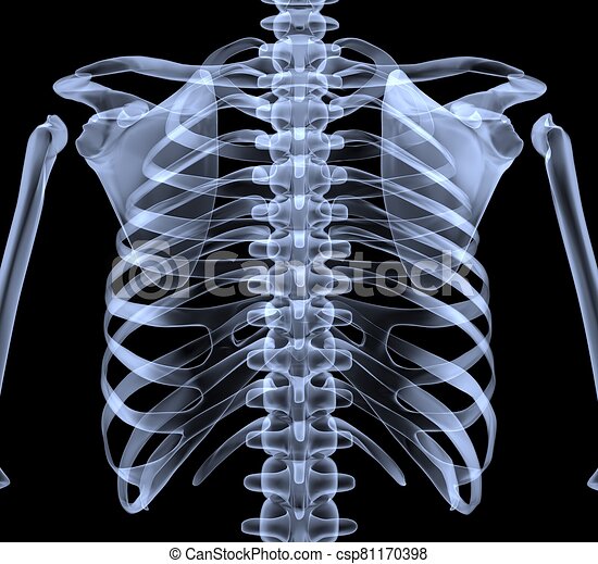 Detail Chest X Ray Clipart Nomer 23