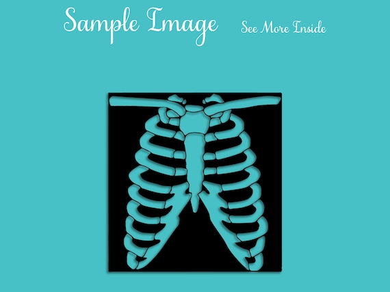 Detail Chest X Ray Clipart Nomer 24