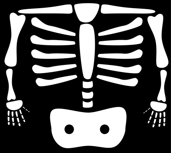 Detail Chest X Ray Clipart Nomer 40