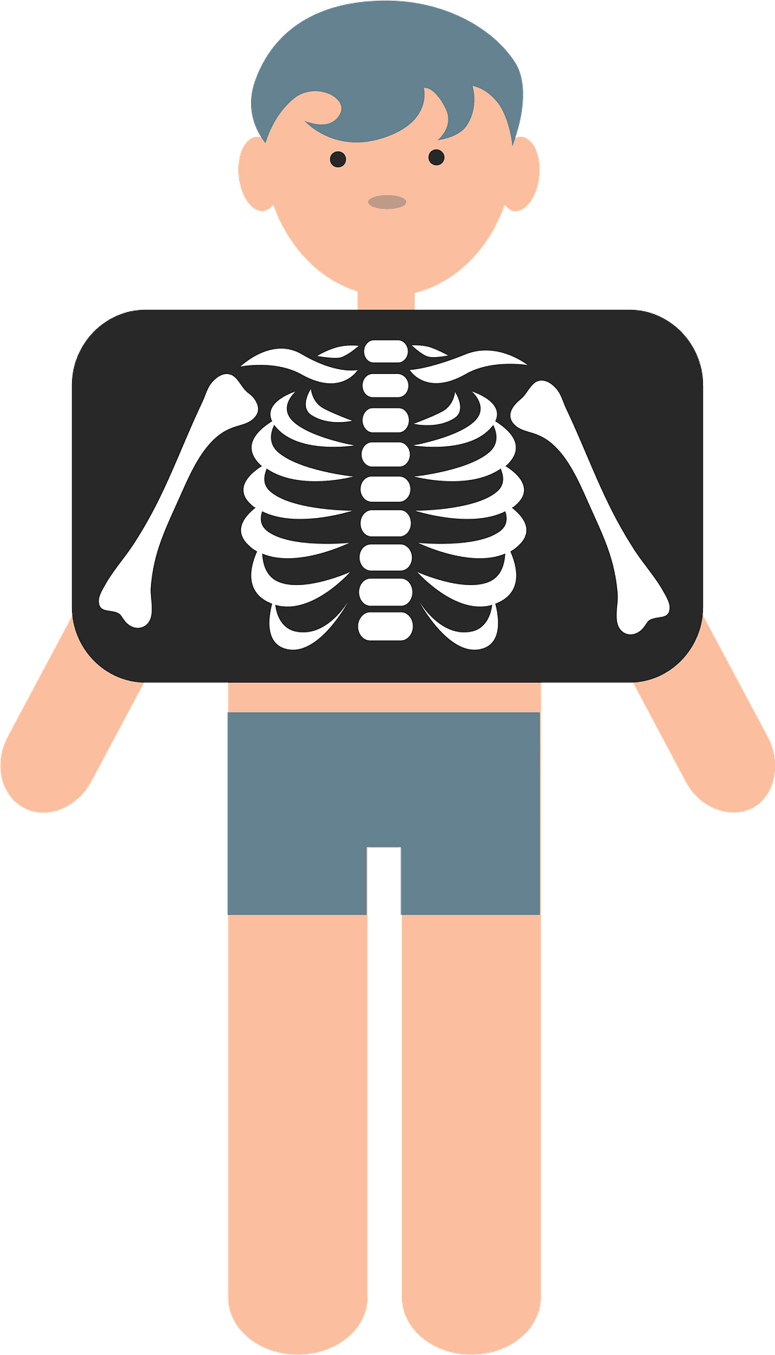 Detail Chest X Ray Clipart Nomer 4