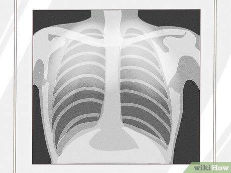 Detail Chest X Ray Clipart Nomer 44