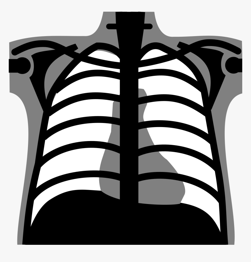 Detail Chest X Ray Clipart Nomer 5