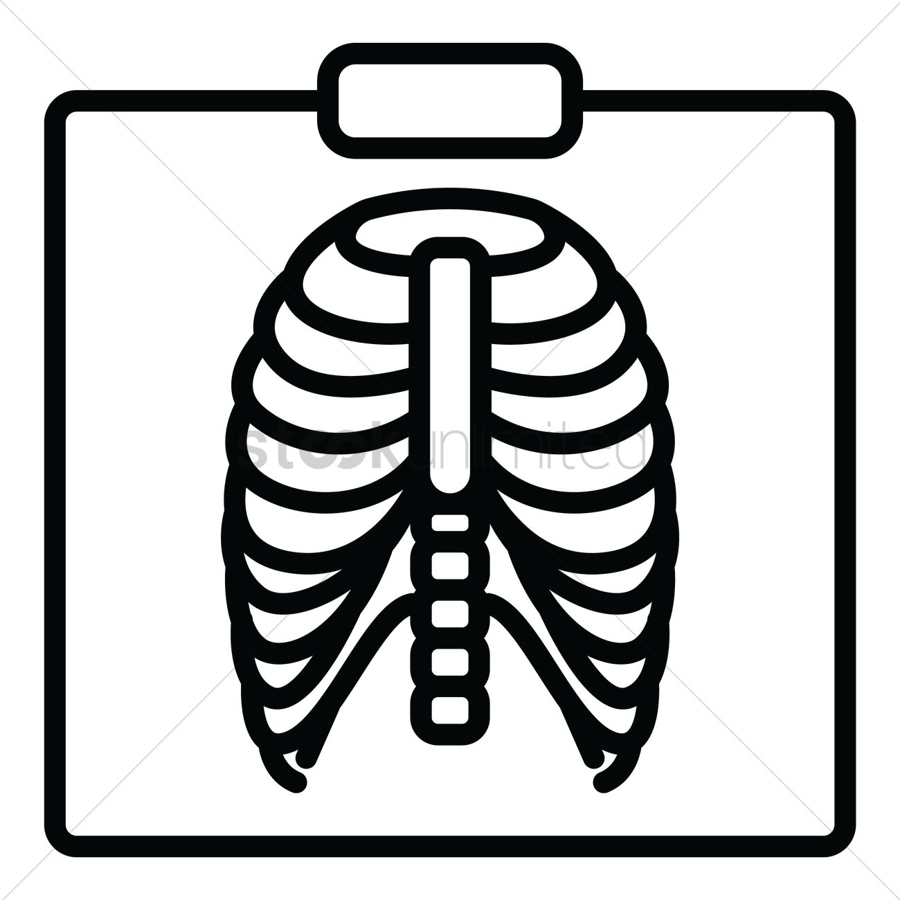 Detail Chest X Ray Clipart Nomer 6