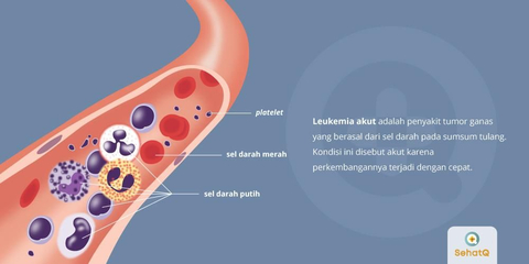 Detail Gambar Bintik Merah Pada Penderita Leukemia Nomer 46