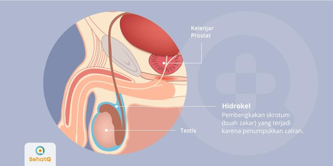 Detail Gambar Buah Zakar Nomer 54